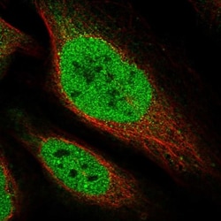 CTDSPL2 Antibody, Novus Biologicals 0.1mL; Unlabeled:Antibodies, Polyclonal